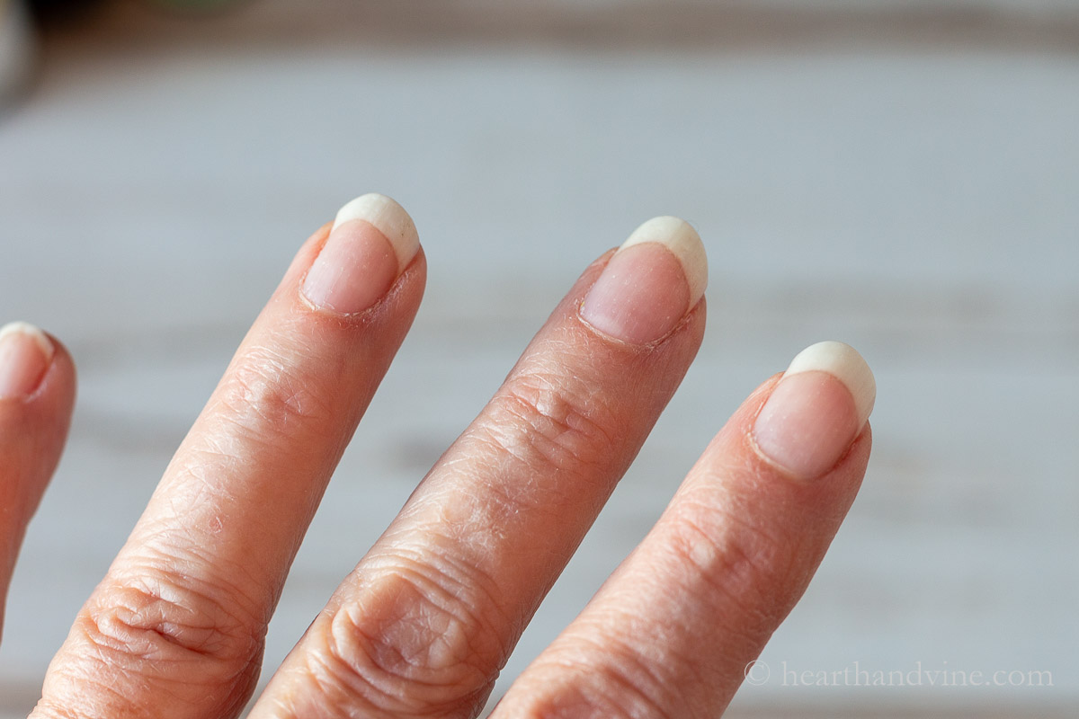 Fingers on a hand with dry cuticles.