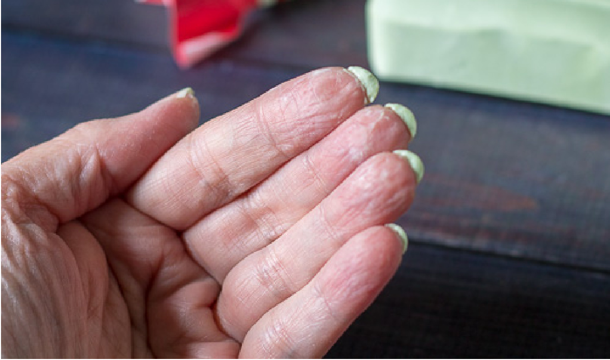 Green soap under finger nails.